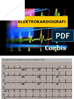 13b ElektrokardiografiLagi