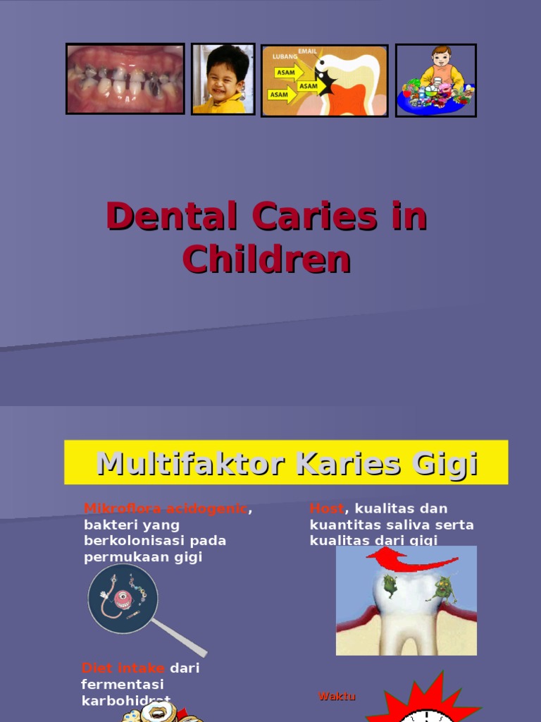 Dental Caries In Children 1 PDF