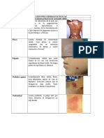 Lesiones dermatológicas: máculas, placas, pápulas y más