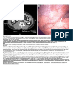 Acute Surgical Abdomen