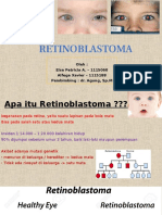 MT Retinoblastoma