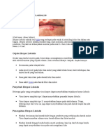 Herpes Labialis: Gejala, Penyebab, Pencegahan dan Pengobatan