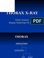 Thorax X Ray