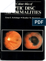 A Colour Atlas of Optic Disc Abnormalities_Kritzinger, Beaumont_1987