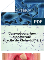 Difteria 