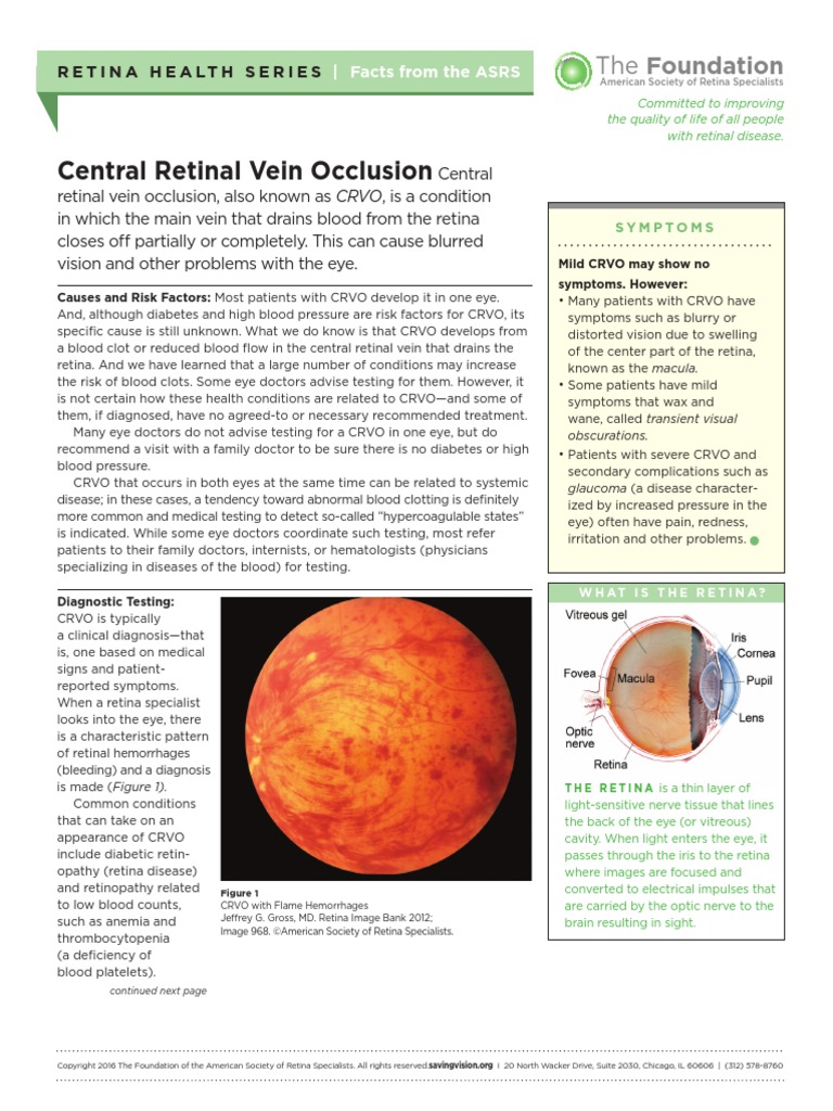 Fact Sheet Central Retinal Vein Occlusion | PDF | Retina | Human Eye