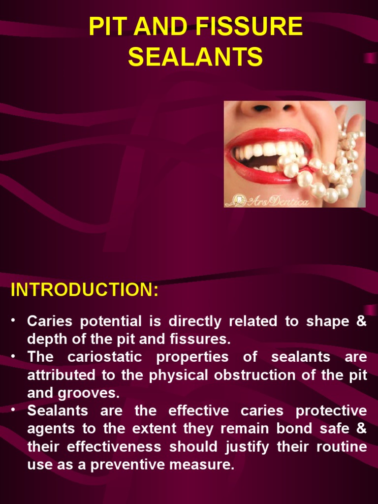 Pit and Fissure Sealants PDF Dentistry Mouth