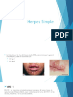 Herpes Simple