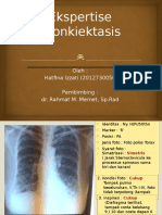 Bronkiektasis: Penyakit Paru Dilatasi Bronkus Kronis