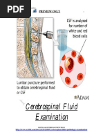 Cerebrospinal Fluid Examination: Preview Only