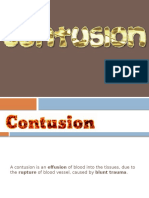 Contusion