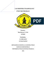 Pneumothorax Ibnu Radiologi