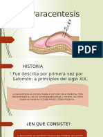 Paracentesis