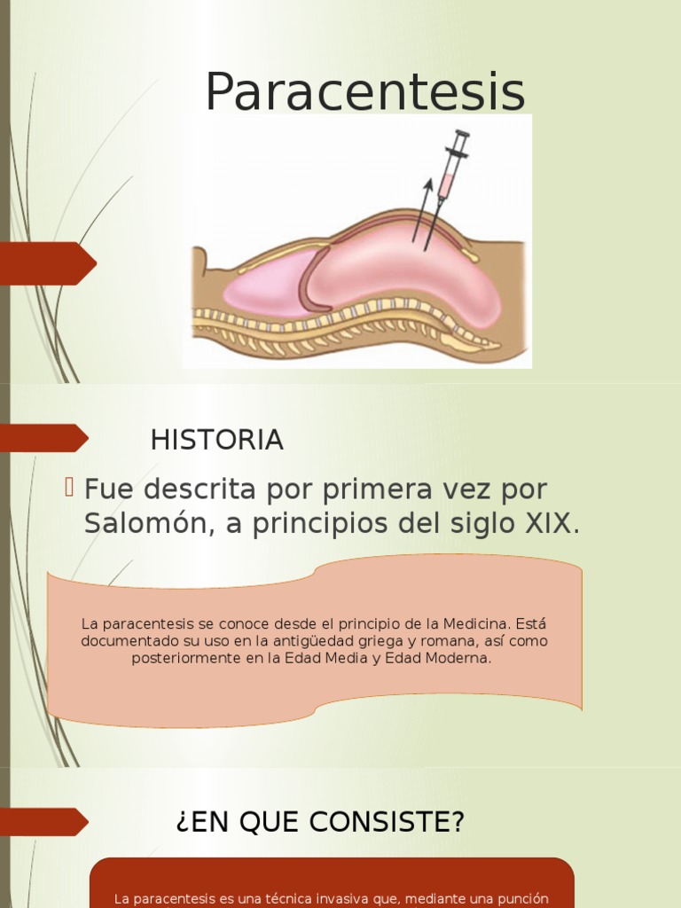 Técnica de Paracentesis en Medicina | PDF | Ciencias de la Salud ...