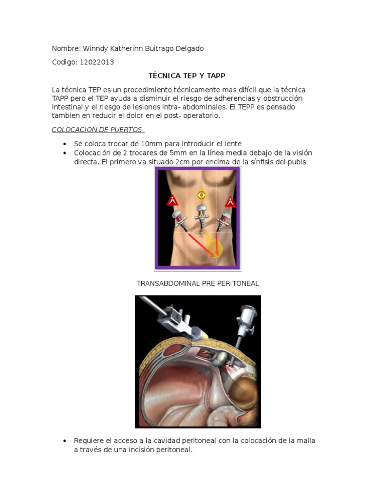 Comparativa de Técnicas TEP y TAPP | PDF | Peritoneo | Abdomen