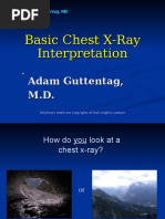 Normal CT Chest Anatomy Overview | PDF | Ct Scan | Diseases And Disorders