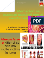 ateroscleroza