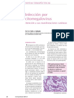 citomegalovirus.pdf