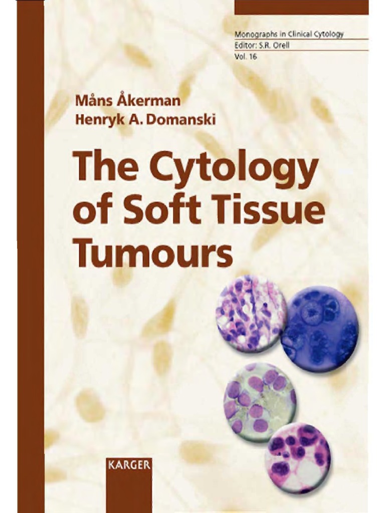 Cytology of Soft Tissue Tumours 2003 PDF | PDF | Cytopathology | Biopsy