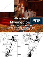 Myomectomy