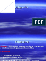 Polimiosistis
