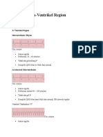 EKG Aritmia