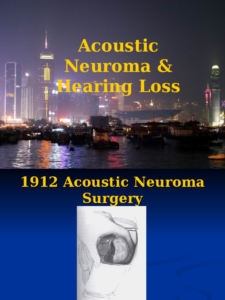 Acoustic Neuroma Acoustic Neuroma & Hearing Loss