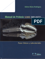 Manual de Protesis Sobre Implantes - Matos