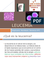 Leucemia 