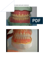 Un Buen Enfilado Dentario