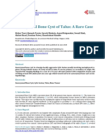 Aneurysmal Bone Cyst of Talus: A Rare Case