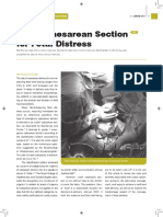 CMEarticleJPOG JanFeb2015_ Crash Caesarean Section for Fetal Distress