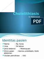 Cholelithiasis SRI