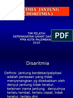 Aritmia (Disritmia)