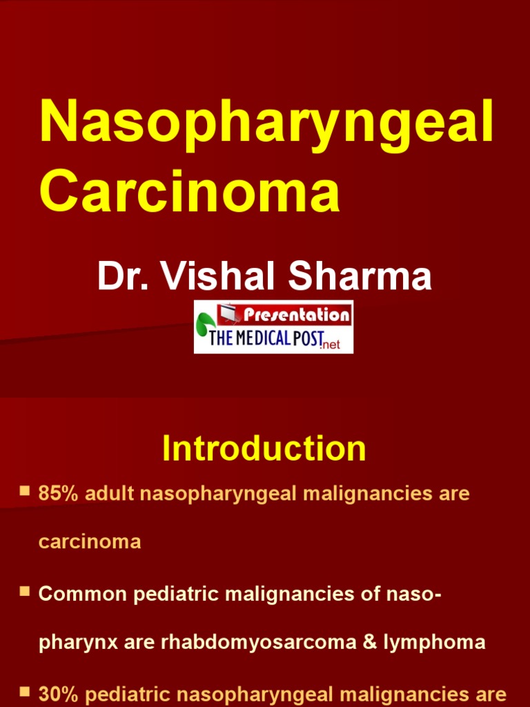 Understanding Nasopharyngeal Carcinoma | PDF | Radiation Therapy ...