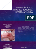Patología Bucal, Tumores Benignos