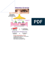 Patofisiologi MG