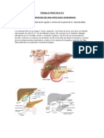 COLECISTITIS