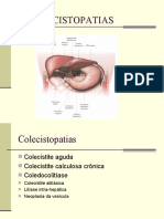 Colecistopatias