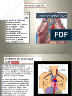 Arterioesclerosis PM1