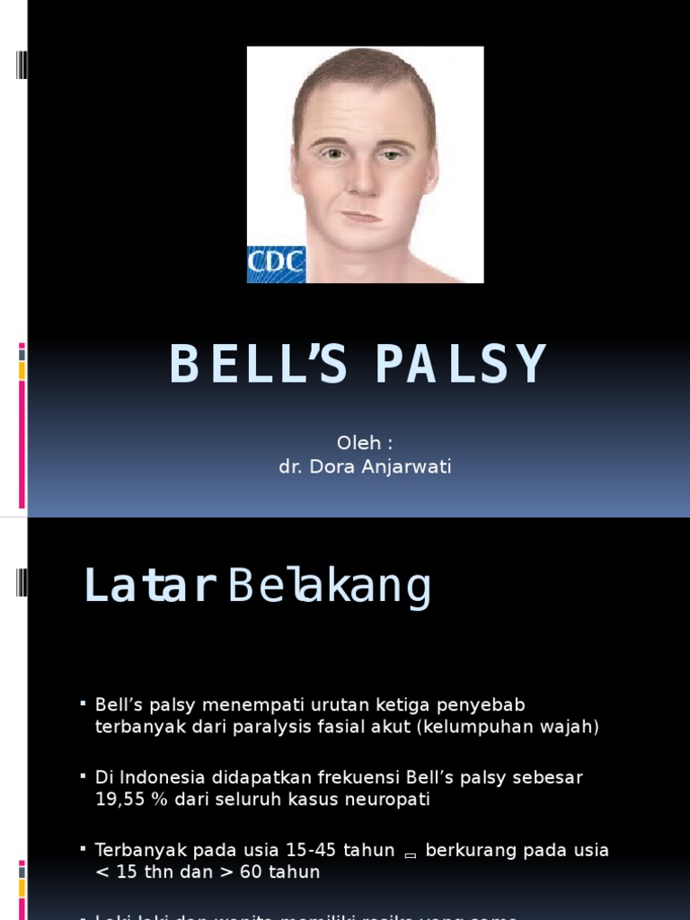 Bell's Palsy | PDF