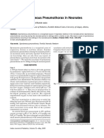 13. Familial Spontaneous Pneumothorax in Neonates