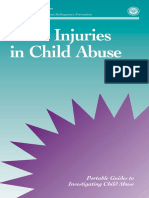 Burn Injuries in Child Abuse