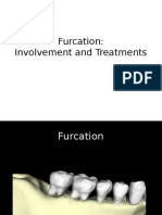 Furcation: Involvement and Treatments