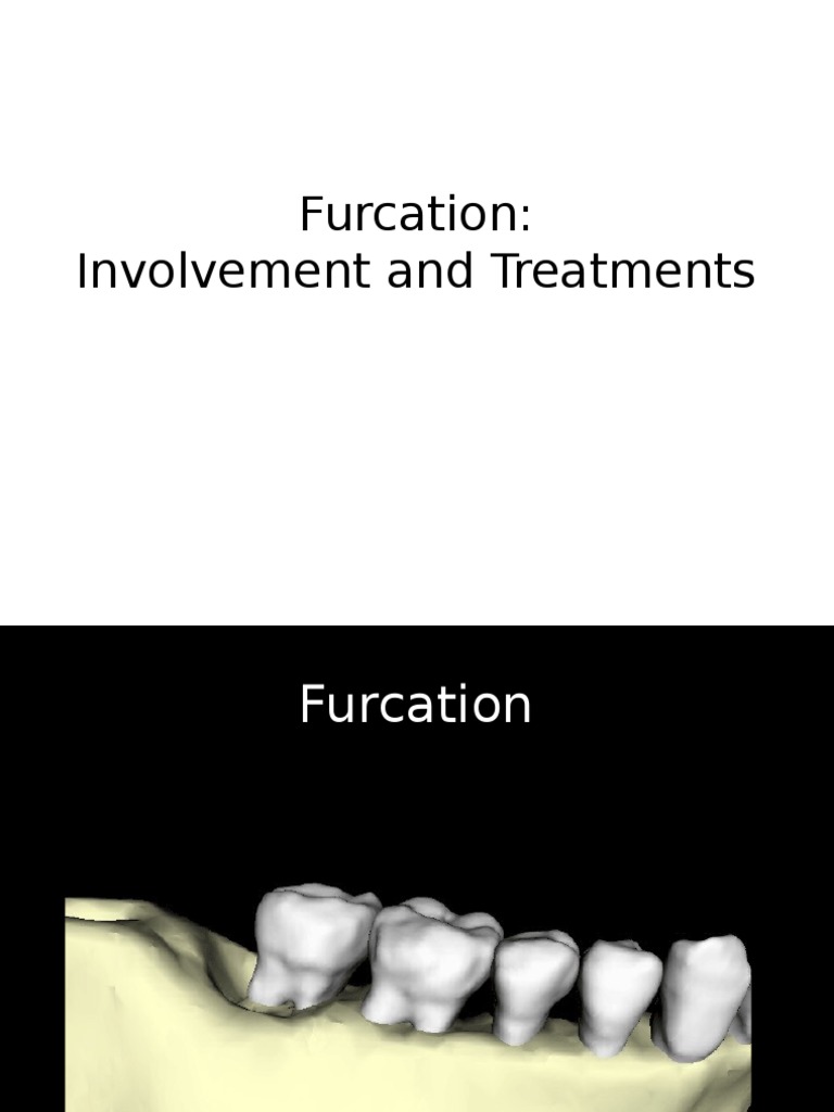 Furcation Involvement and Treatments PDF Dentistry Branches