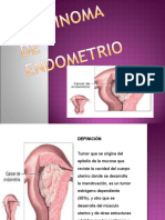 Carcinoma de Endometrio