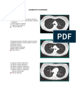 Segmentos Pulmonares