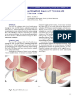 qweqwAlternate sinus lift techniques- literature review.pdf