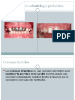 Coronas en Odontología Pediatrica