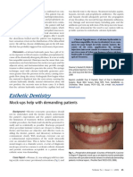 Mock-ups help with demanding patients